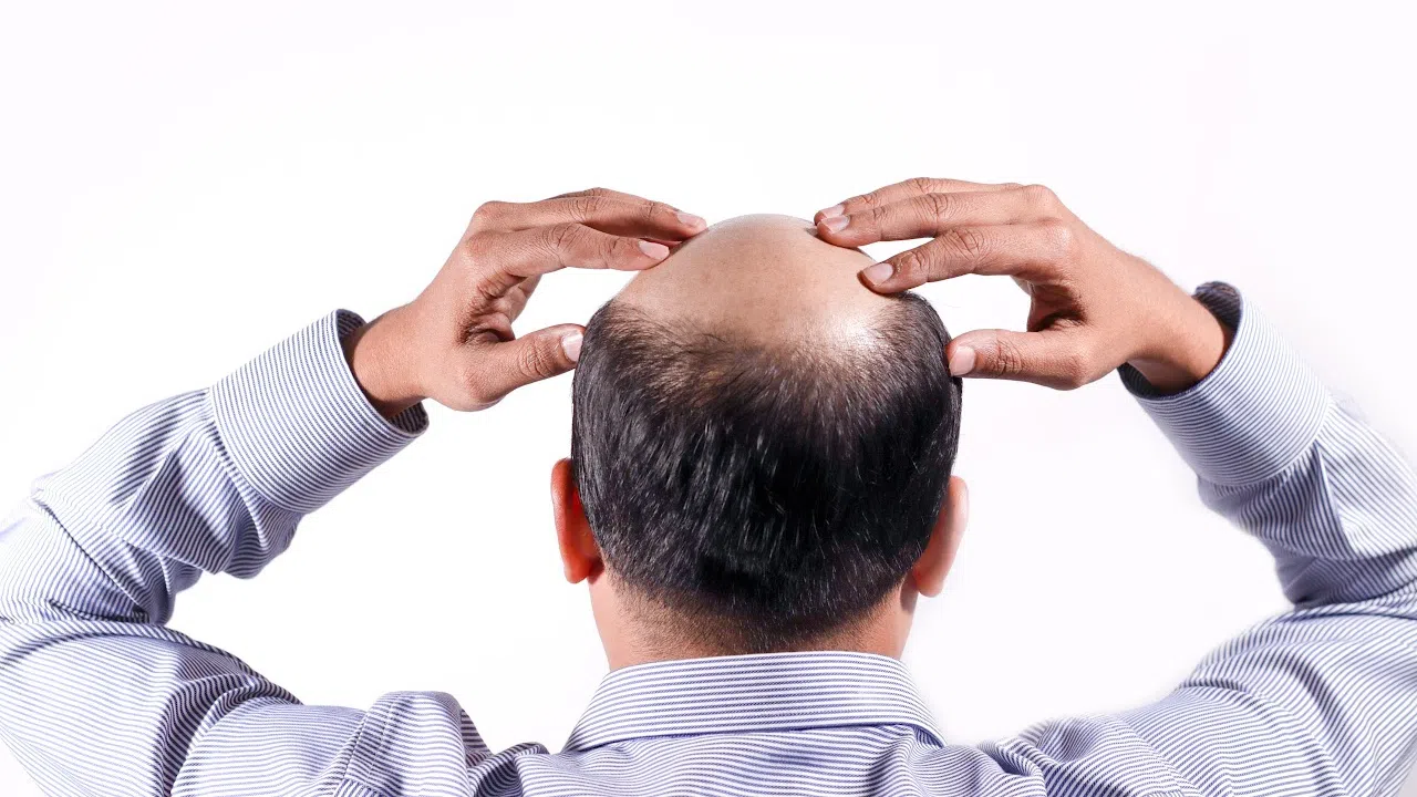 Brant Hansen on Studies That Show Men Don’t Like Going Bald | PRAISE 106.5