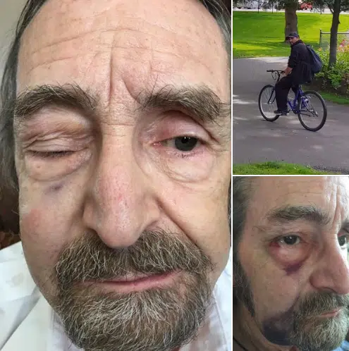 Senior Kamloops security guard recovering after being sucker-punched by stranger