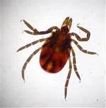 Hampton Veterinarian Offers Tick-Removal Tips For Pet-Owners