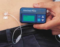 Province Announces New Pediatric Insulin Pump Program