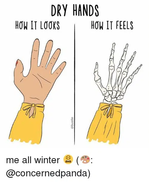 Dry Hands ... Tips To Prevent Cracking Up This Year.