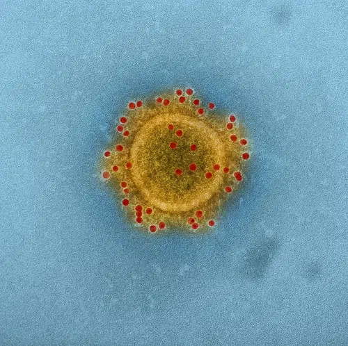 Two Confirmed Coronavirus Cases In Ontario