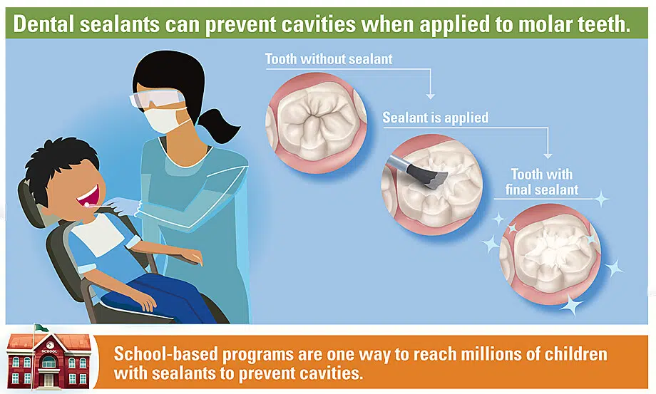 Health Unit Express Importance Of Proper Dental Care