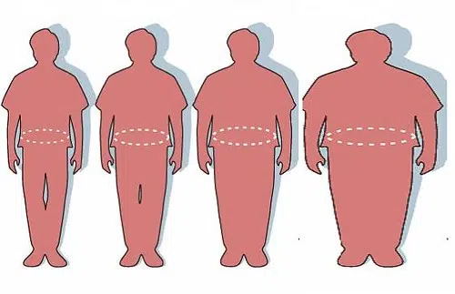 Wisconsin Obesity Rate Stays the Same While Rest of Country Gets More Obese