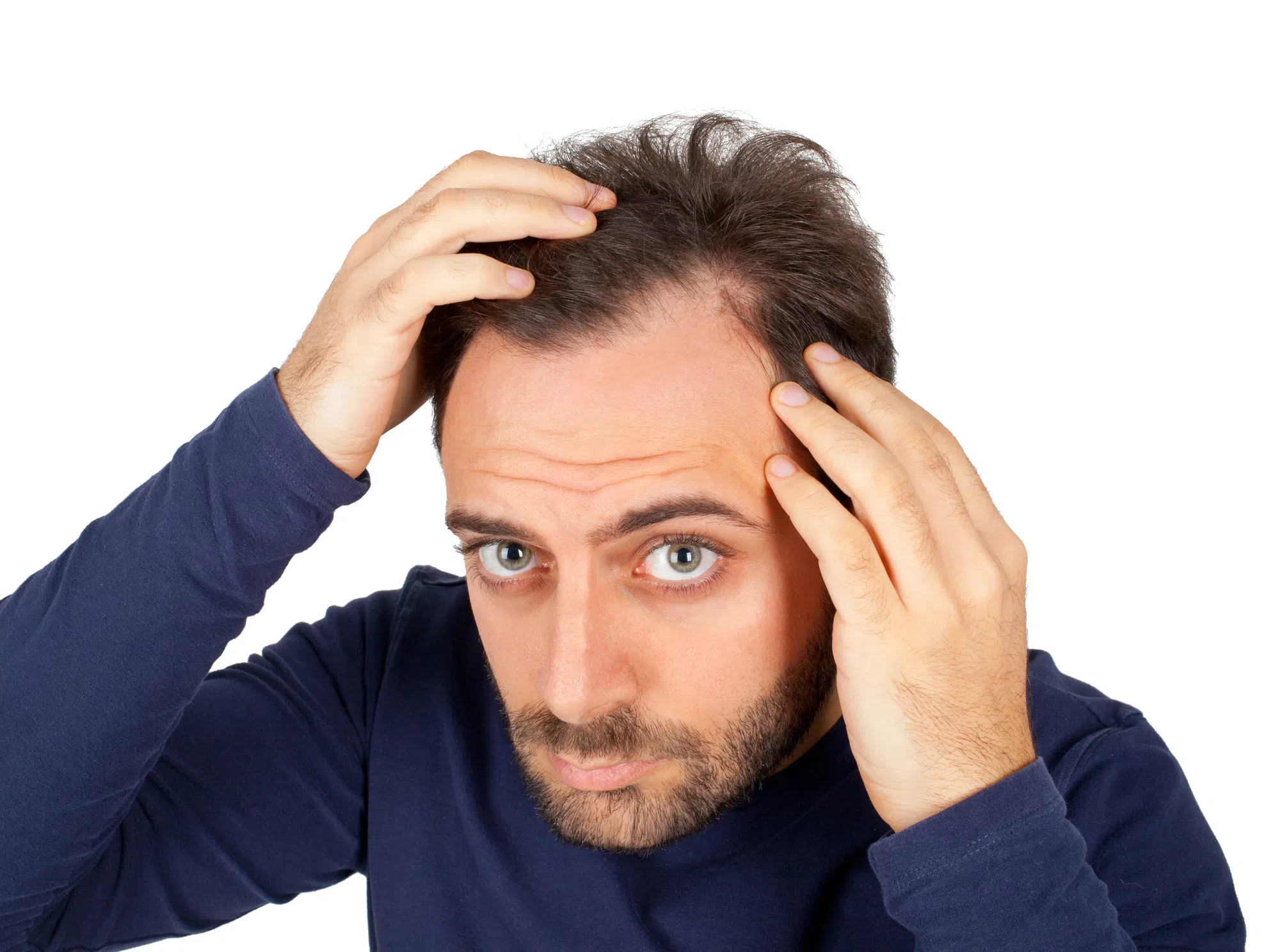 Hair Loss Survey