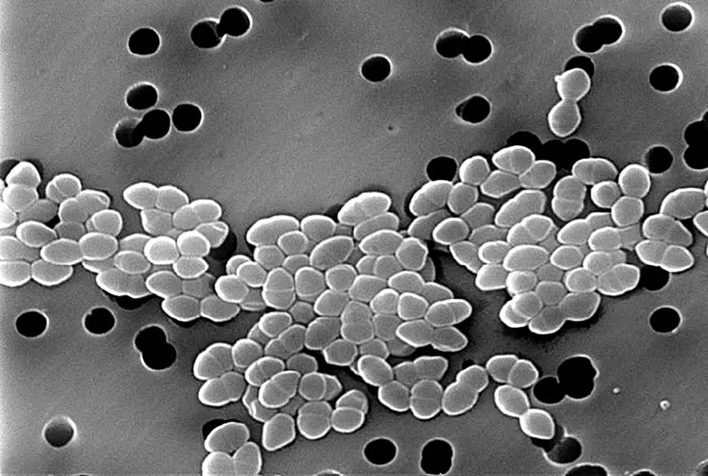 VRE outbreak at medicine units