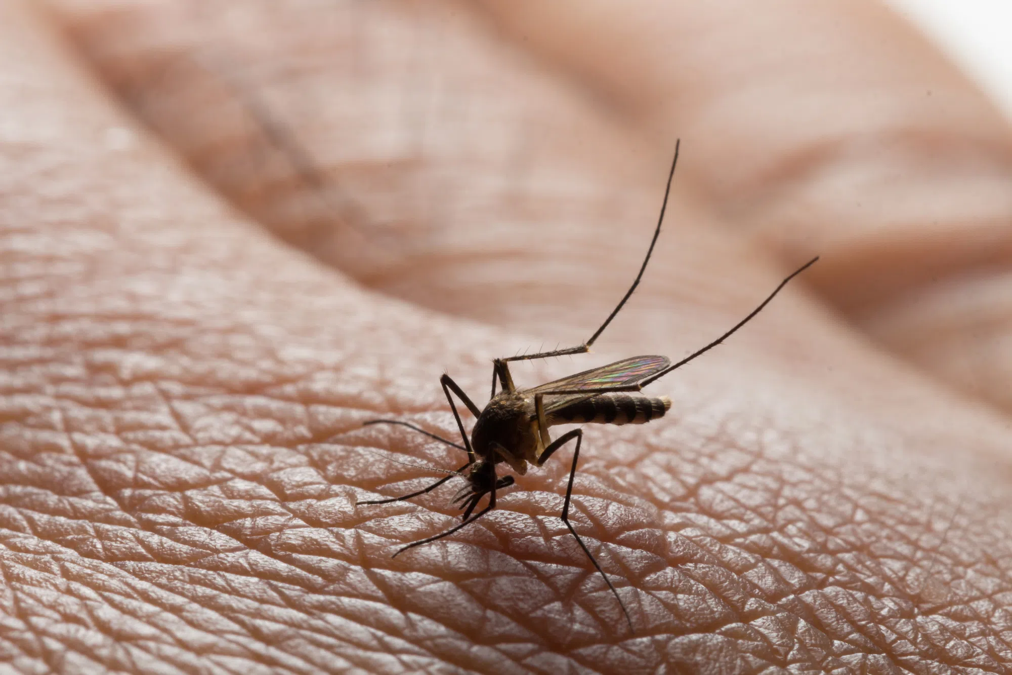 Human case of West Nile virus confirmed in community