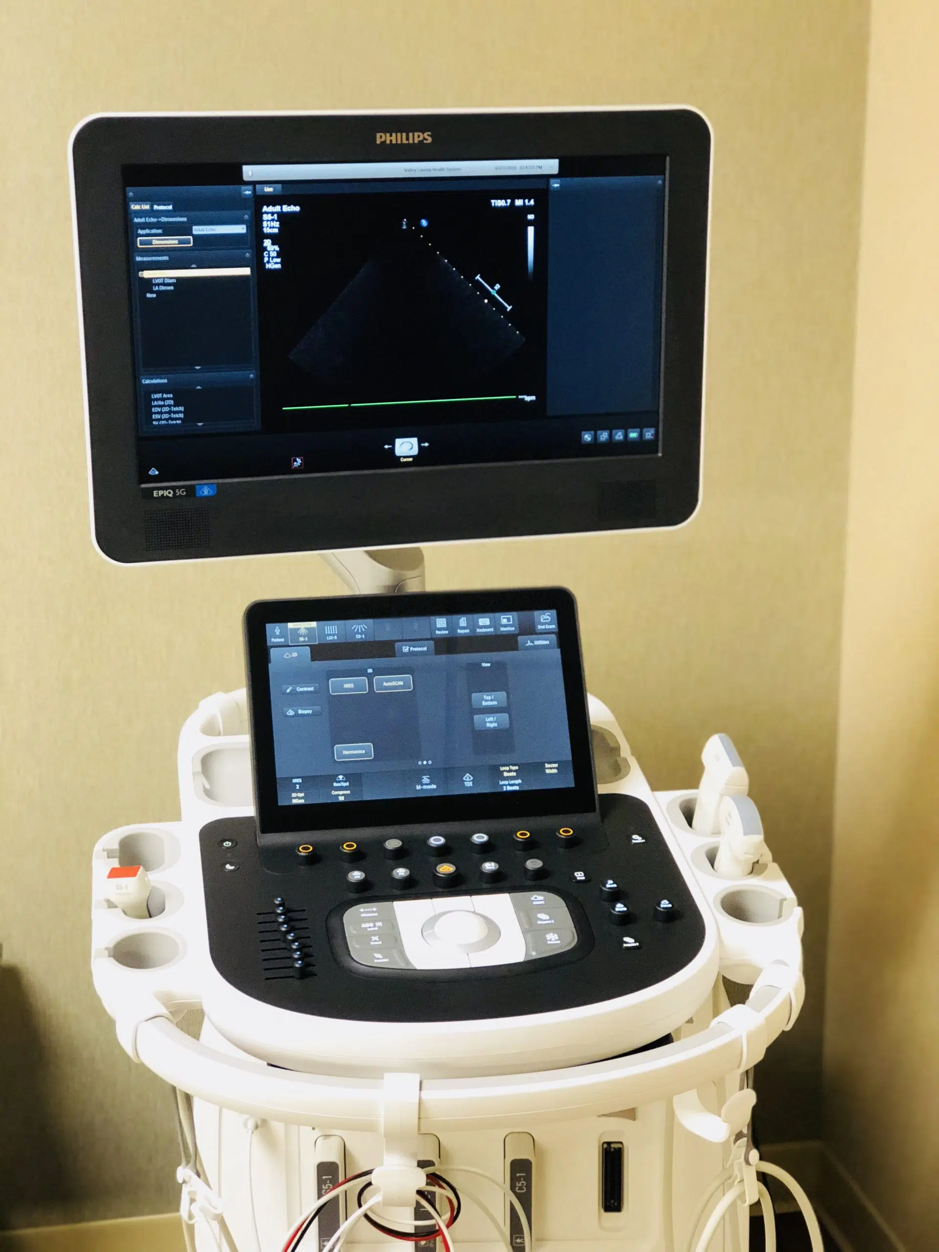 VCHS Foundation donates $86,000 for new Epiq 5G Ultrasound.