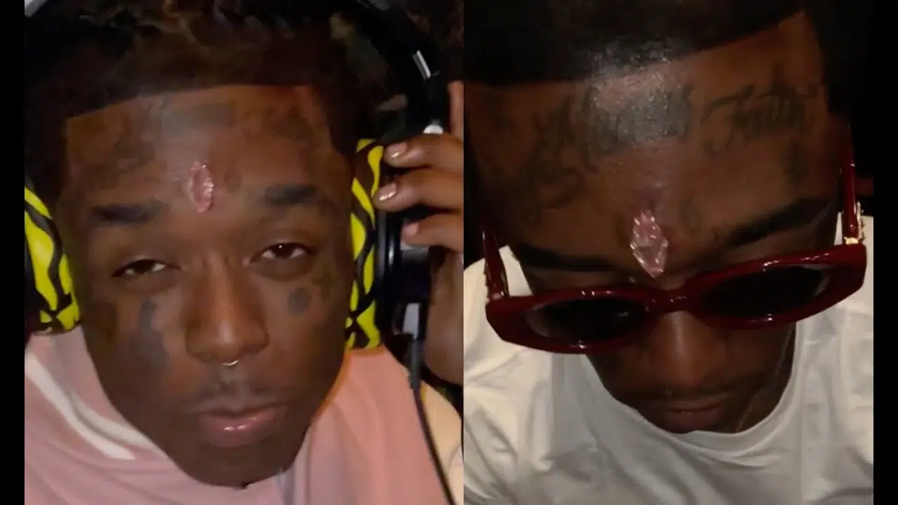 Rapper Lil Uzi Vert Reportedly Got a Pink Diamond Embedded in His Forehead