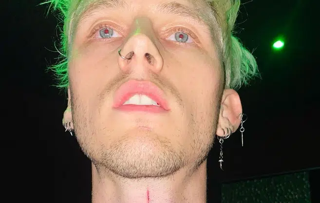 Machine Gun Kelly Gets an Extremely Realistic Neck Slit Tattoo [PIC]
