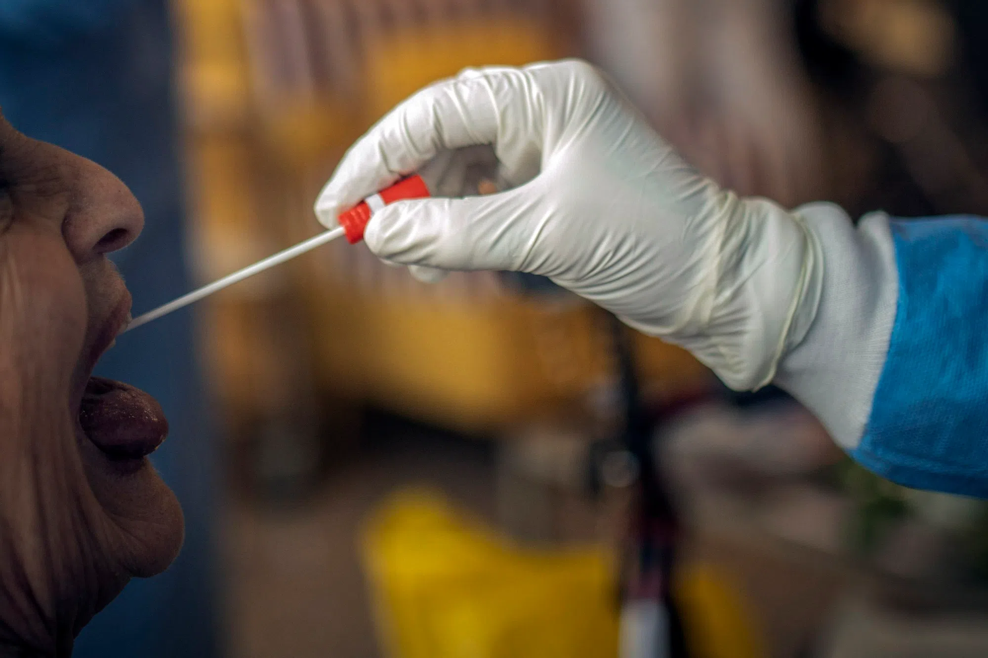 US OKs 1st Coronavirus Test That Allows Self-Swab At Home