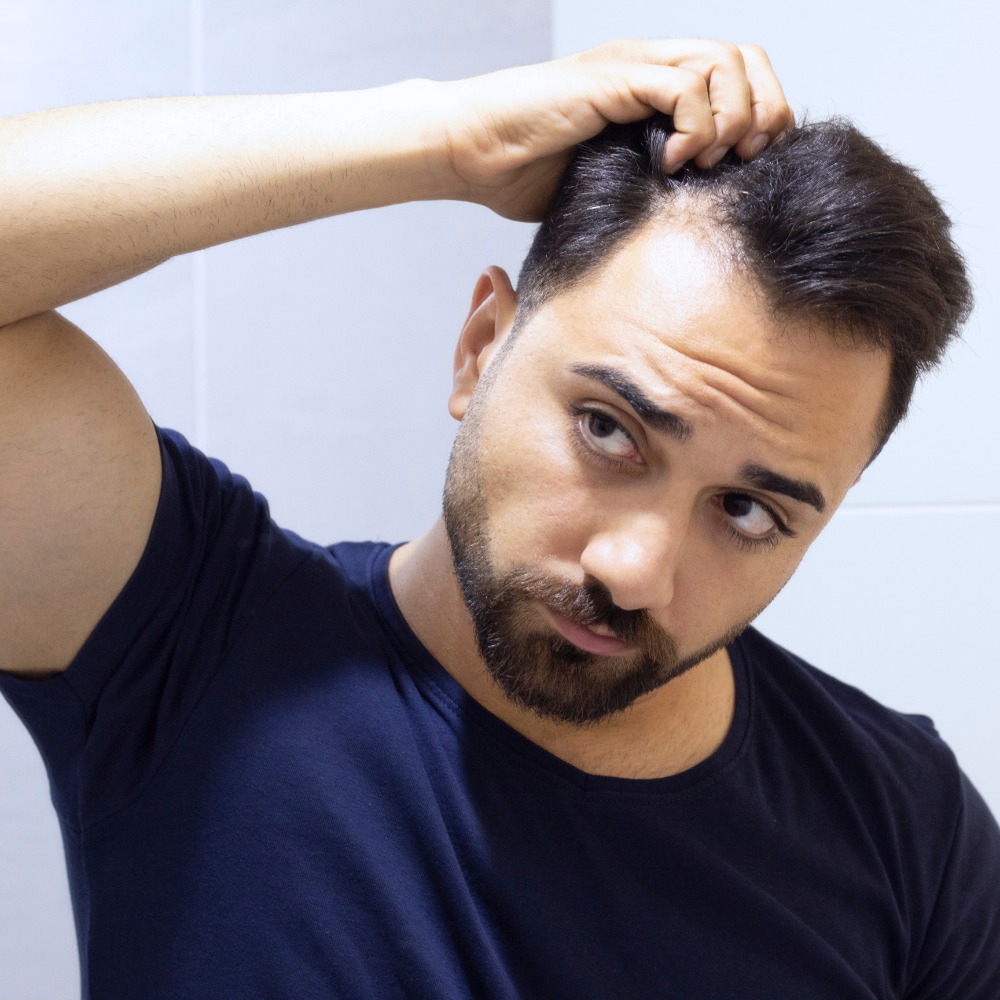 When Should You Start Looking for Solutions to Hair Loss?
