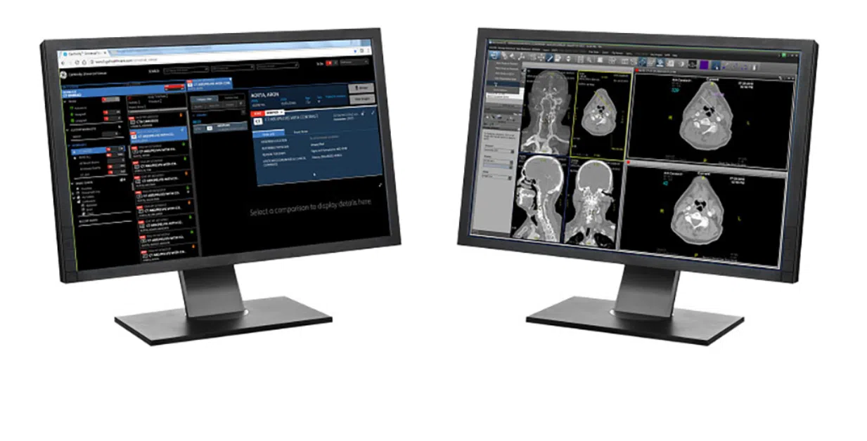 New fetal monitoring package coming to NRH