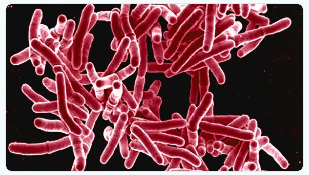 Oyenuga: KC-area tuberculosis outbreak unlikely to reach Lyon County