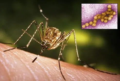 Kankakee County Man Illinois' First 2017 Human West Nile Death