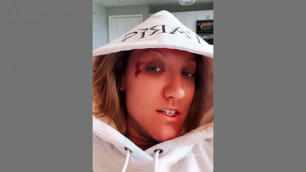 Nebraska Volleyball Assistant Jordan Larson Reveals Injuries from Paris