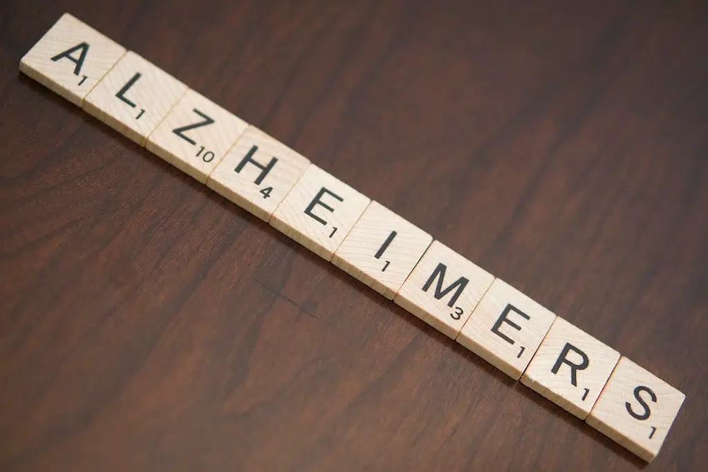 Twelve Actions to Reduce Your Risk of Dementia.