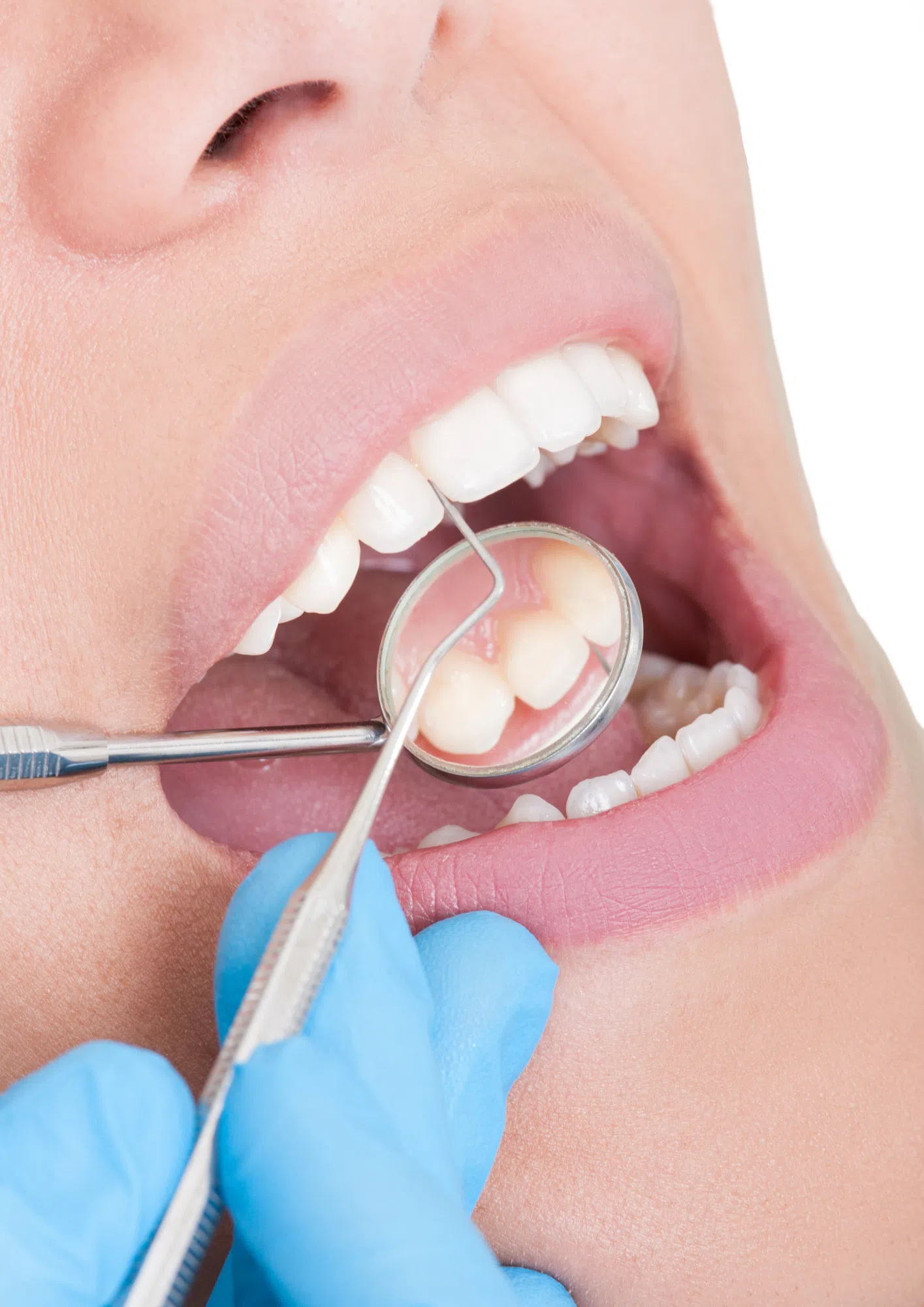 Few N.B. dentists register for new federal dental plan