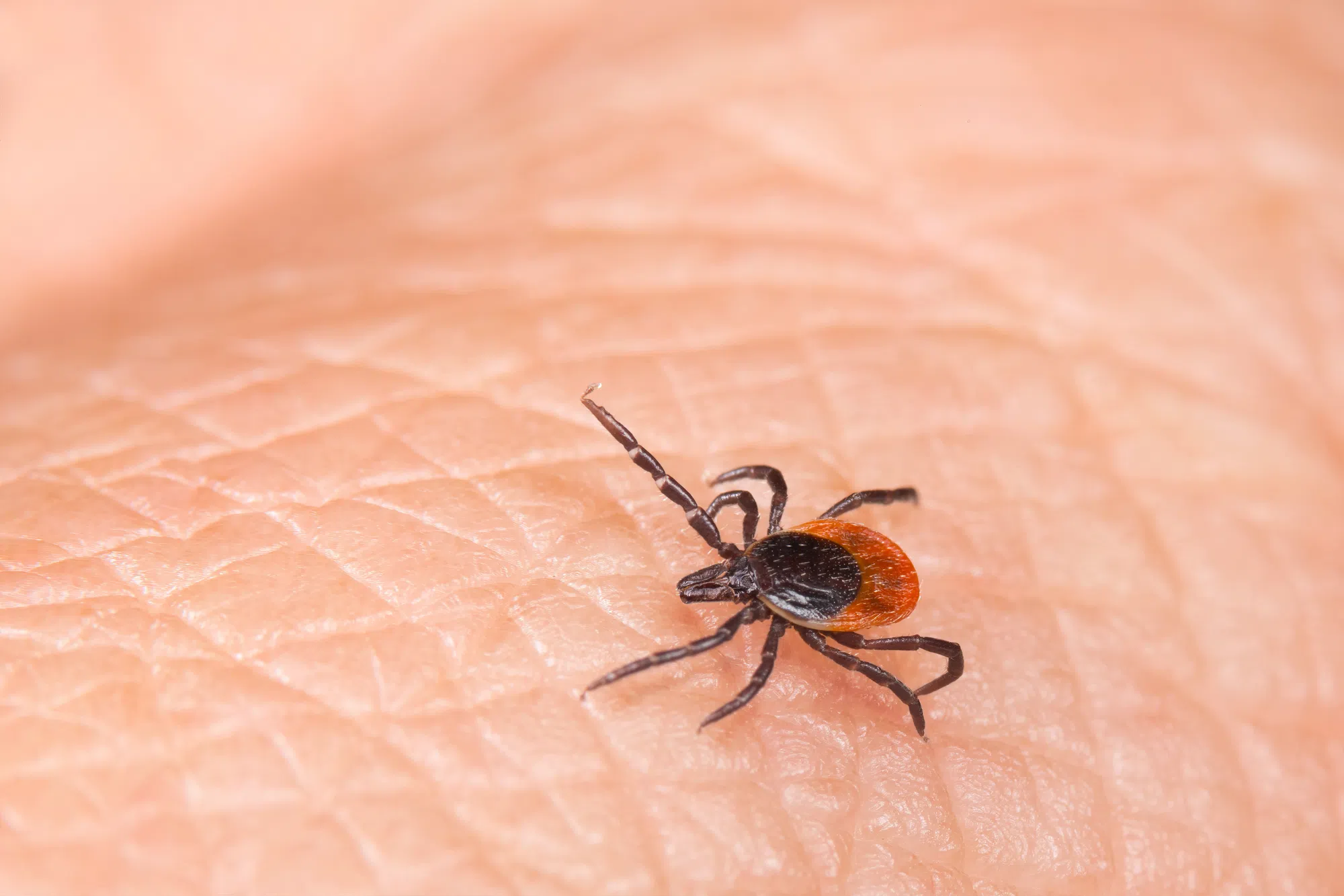Lyme Awareness Month highlights rising tick risks and how to protect yourself