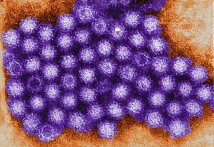 Norovirus 2