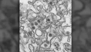 Zika