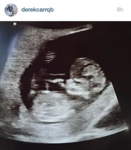 Baby Carr