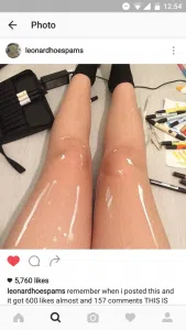 legs
