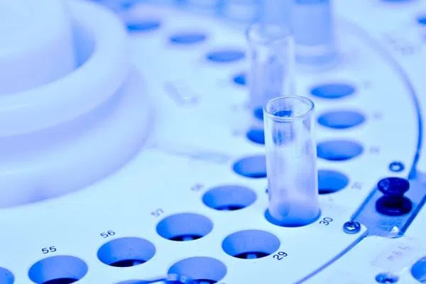 Blood tubes in the laboratory