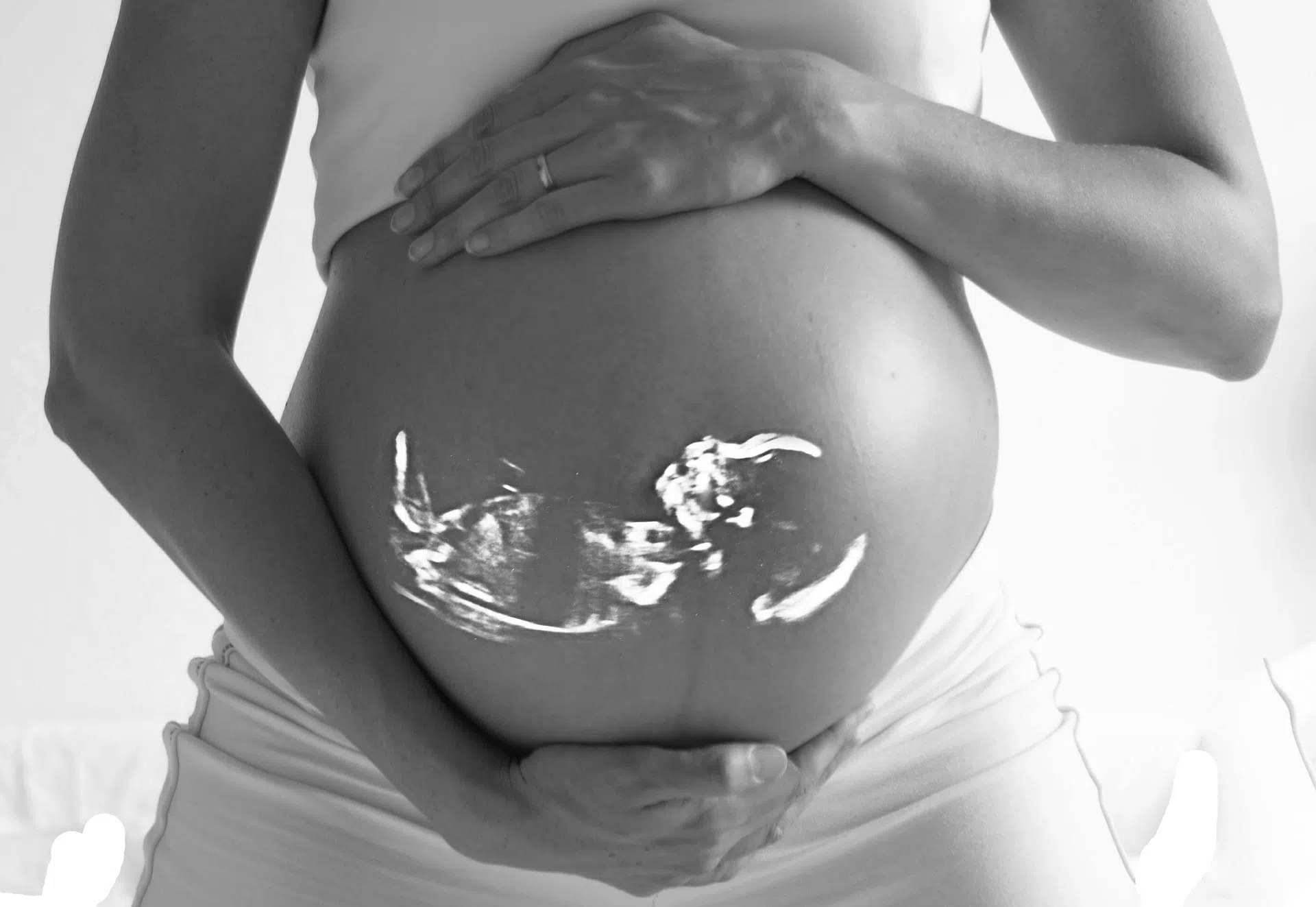 Ultrasound