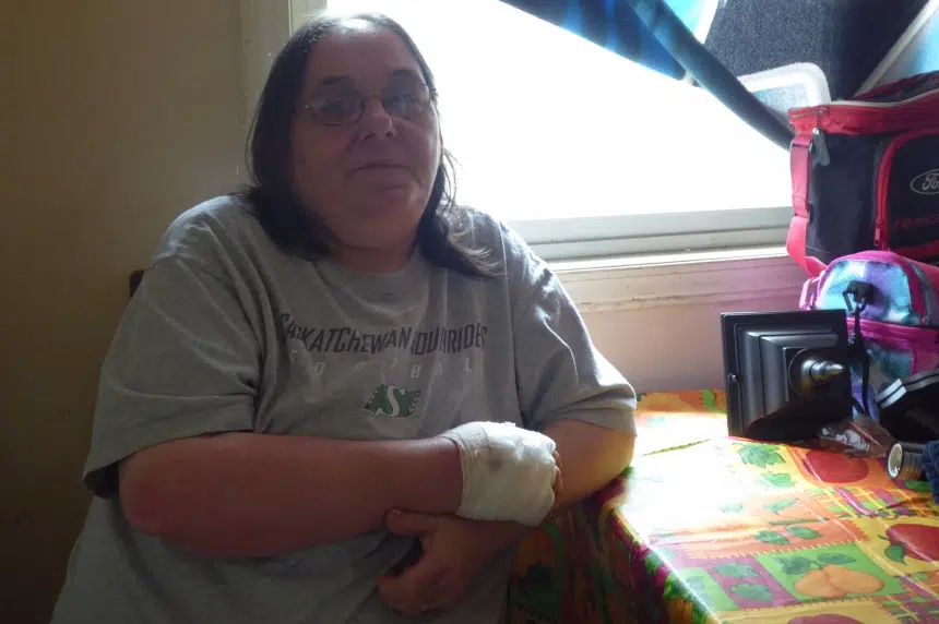 Woman who was attacked by a dog speaks out