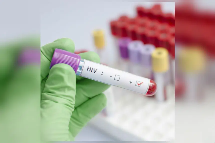 HIV Testing Day being marked across Saskatchewan