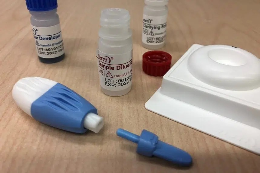 Free HIV at-home testing kits now available in Saskatchewan