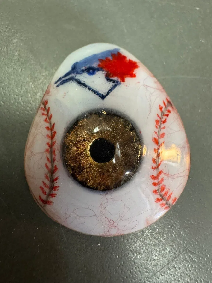 Prosthetic eye.