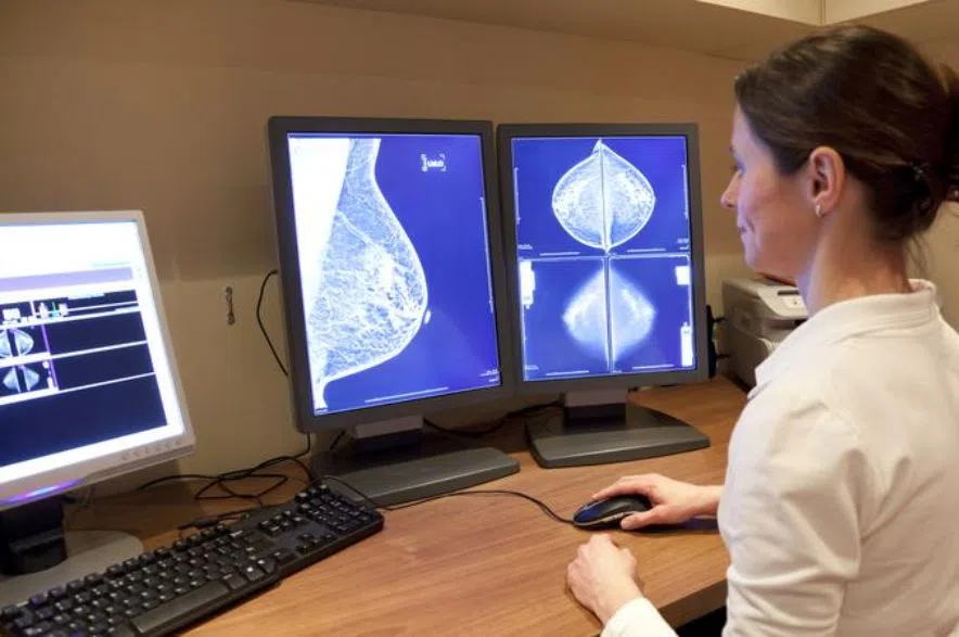 mammogram screening