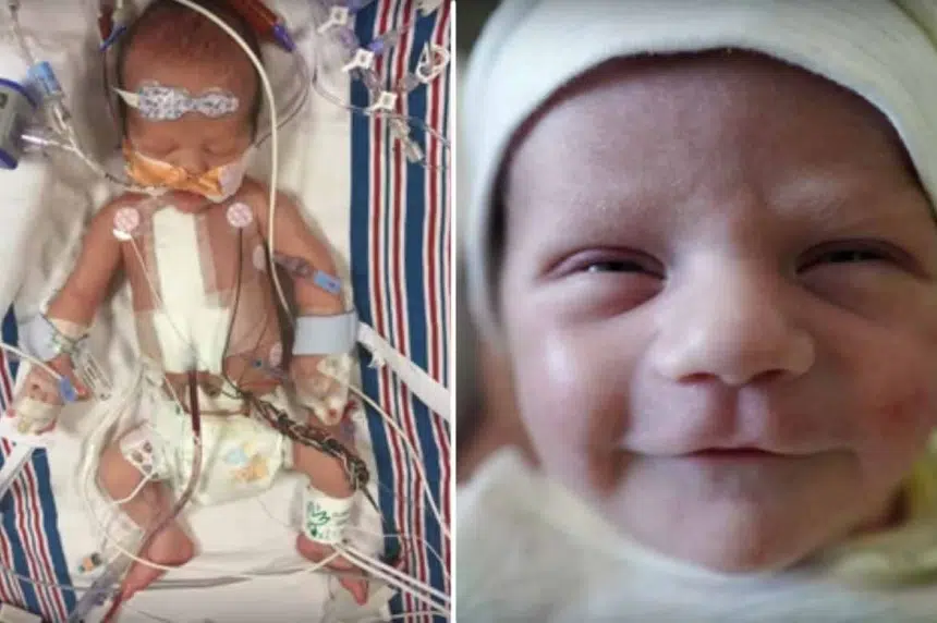 Emotional Kimmel shares story of newborn son's surgery