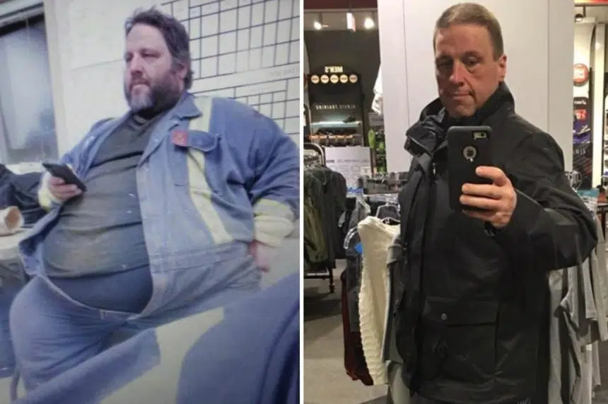 Man says Fort McMurray wildfire saved his life by forcing weight loss