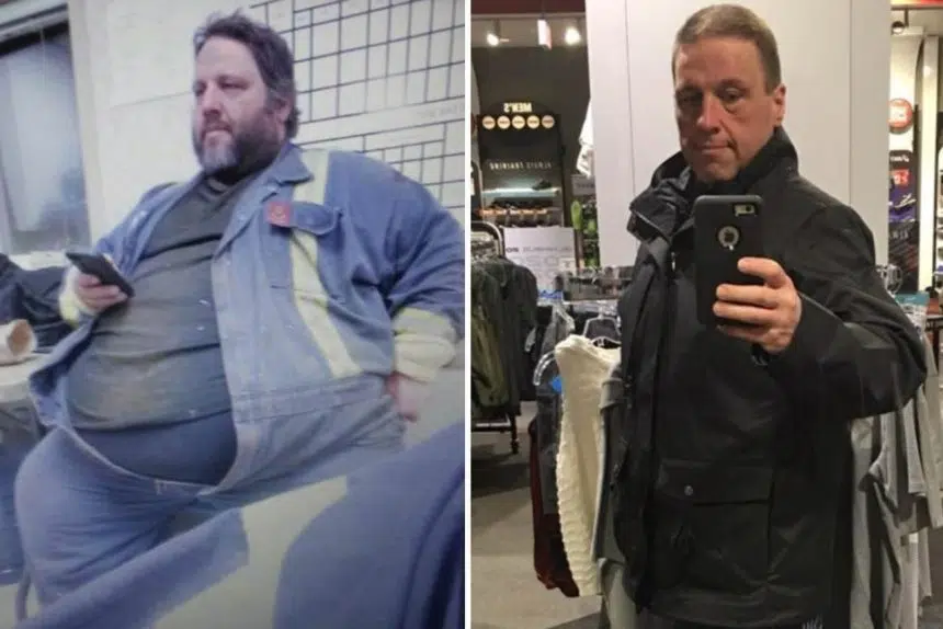 Man says Fort McMurray wildfire saved his life by forcing weight loss