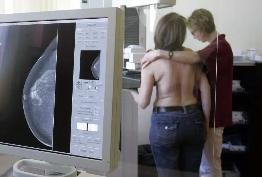 Sask. turns to Calgary to cut 'unacceptable' wait times for breast cancer diagnoses