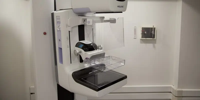 Around 11,000 Mammograms Identified for Review in Health Authorities