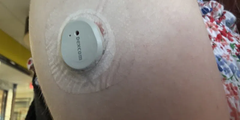 Government Expanding Glucose Monitoring Program to Include All Type 1 Diabetics