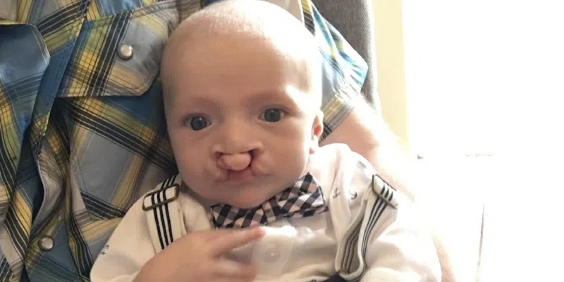 MCP Cuts Force Family to Seek Donations