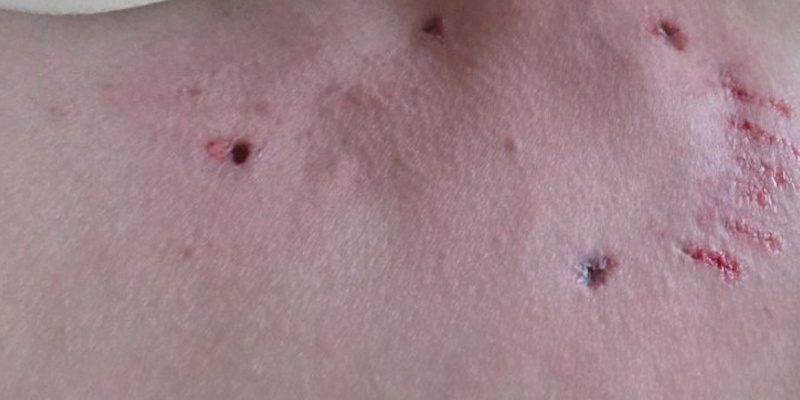 RCMP Investigating Dog Attack in Sheshatshiu